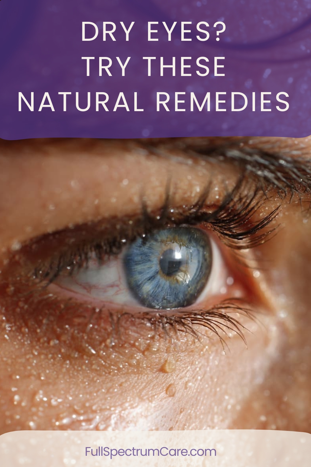 pinterest graphic for natural remedies for dry eyes and eye fatigue with soothing wellness eye care tips